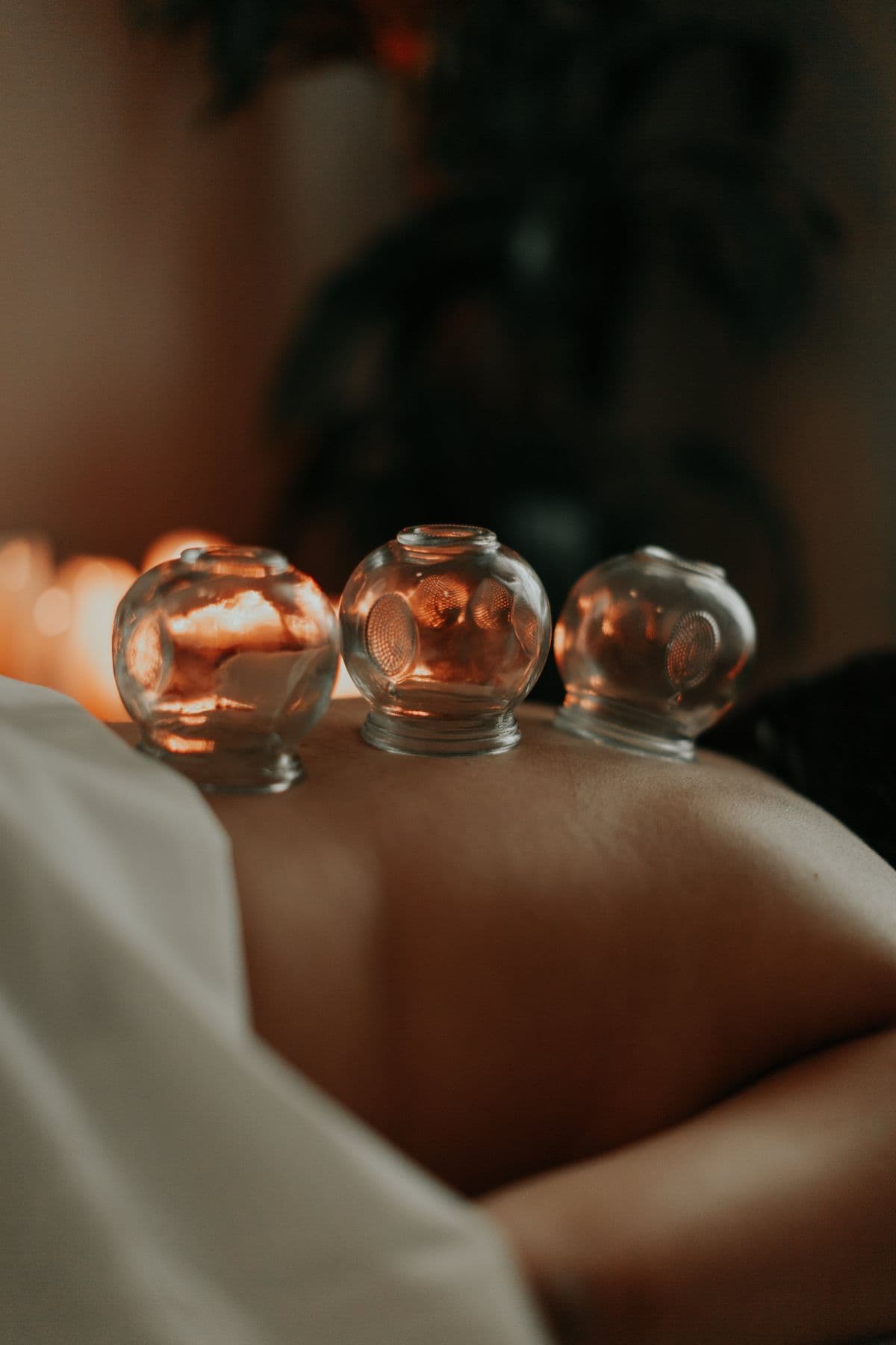 Glass cups placed on the back during traditional cupping